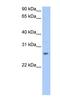 Cysteine Rich Secretory Protein 1 antibody, NBP1-79533, Novus Biologicals, Western Blot image 