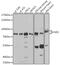 Neurofibromin 2 antibody, GTX35202, GeneTex, Western Blot image 