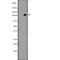 Leucine Rich Repeat Containing G Protein-Coupled Receptor 4 antibody, abx147485, Abbexa, Western Blot image 