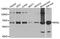 Ribophorin II antibody, A8352, ABclonal Technology, Western Blot image 