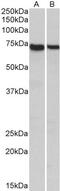 Syntaxin Binding Protein 3 antibody, PA5-37892, Invitrogen Antibodies, Western Blot image 