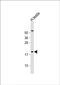 CT45A antibody, PA5-71593, Invitrogen Antibodies, Western Blot image 