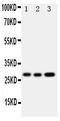 Oncostatin-M antibody, PA1668, Boster Biological Technology, Western Blot image 