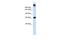Sucrase-Isomaltase antibody, A04542, Boster Biological Technology, Western Blot image 