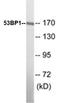 Tumor Protein P53 Binding Protein 1 antibody, EKC1007, Boster Biological Technology, Western Blot image 