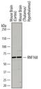 Ring Finger Protein 168 antibody, AF7217, R&D Systems, Western Blot image 