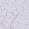 DDB1 And CUL4 Associated Factor 17 antibody, HPA053339, Atlas Antibodies, Immunohistochemistry frozen image 