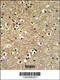 ETS Proto-Oncogene 2, Transcription Factor antibody, 64-143, ProSci, Immunohistochemistry paraffin image 