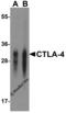 Cytotoxic T-Lymphocyte Associated Protein 4 antibody, RF16011, ProSci, Western Blot image 