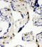 Minichromosome Maintenance Complex Component 6 antibody, LS-C312918, Lifespan Biosciences, Immunohistochemistry paraffin image 