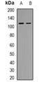 General Transcription Factor IIIC Subunit 2 antibody, orb339020, Biorbyt, Western Blot image 