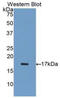 Inhibin Subunit Alpha antibody, OACD04786, Aviva Systems Biology, Western Blot image 