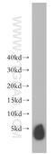 Sarcolipin antibody, 18395-1-AP, Proteintech Group, Western Blot image 