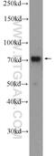 Rac GTPase Activating Protein 1 antibody, 13739-1-AP, Proteintech Group, Western Blot image 