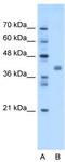 Transmembrane Protein 59 Like antibody, TA341895, Origene, Western Blot image 