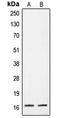 Cellular Retinoic Acid Binding Protein 2 antibody, LS-C352040, Lifespan Biosciences, Western Blot image 