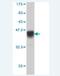 Interleukin 15 Receptor Subunit Alpha antibody, H00003601-M01, Novus Biologicals, Western Blot image 