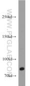 CD248 Molecule antibody, 18160-1-AP, Proteintech Group, Western Blot image 