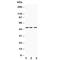 Angiopoietin-related protein 4 antibody, R30505, NSJ Bioreagents, Western Blot image 