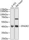 Interferon Gamma Receptor 2 antibody, 19-216, ProSci, Western Blot image 