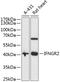 IFN-gamma-R2 antibody, 19-216, ProSci, Western Blot image 