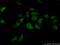 TGFB1-Induced Anti-Apoptotic Factor 1 antibody, 20328-1-AP, Proteintech Group, Immunofluorescence image 