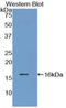 Transthyretin antibody, LS-C296793, Lifespan Biosciences, Western Blot image 