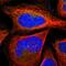 Sarcolemma Associated Protein antibody, HPA002357, Atlas Antibodies, Immunofluorescence image 