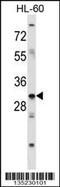 Homeobox B9 antibody, 58-350, ProSci, Western Blot image 