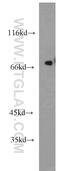 Potassium Voltage-Gated Channel Subfamily A Member Regulatory Beta Subunit 1 antibody, 14697-1-AP, Proteintech Group, Western Blot image 