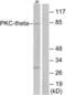 Protein Kinase C Theta antibody, LS-B9243, Lifespan Biosciences, Western Blot image 