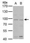 MutL Homolog 1 antibody, GTX101160, GeneTex, Western Blot image 