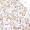 CCCTC-Binding Factor antibody, NBP2-76420, Novus Biologicals, Immunohistochemistry paraffin image 