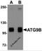Autophagy Related 9B antibody, 5797, ProSci, Western Blot image 