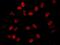 Bromodomain Containing 2 antibody, NBP1-30474, Novus Biologicals, Immunofluorescence image 