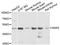 Sorting Nexin 5 antibody, A04788, Boster Biological Technology, Western Blot image 