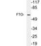 FTO Alpha-Ketoglutarate Dependent Dioxygenase antibody, LS-C199858, Lifespan Biosciences, Western Blot image 