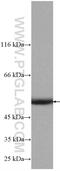 STAM Binding Protein Like 1 antibody, 27315-1-AP, Proteintech Group, Western Blot image 