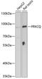 Protein Kinase C Theta antibody, 19-889, ProSci, Western Blot image 