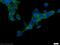 Calcium/Calmodulin Dependent Protein Kinase II Beta antibody, 55218-1-AP, Proteintech Group, Immunofluorescence image 