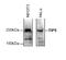 Bromodomain Adjacent To Zinc Finger Domain 2A antibody, CI1016, Boster Biological Technology, Western Blot image 