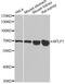 Amyloid Beta Precursor Like Protein 1 antibody, MBS126438, MyBioSource, Western Blot image 