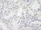 GTF2I Repeat Domain Containing 1 antibody, NB100-61055, Novus Biologicals, Immunohistochemistry paraffin image 