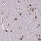 Fragile X Mental Retardation 1 antibody, NBP2-38617, Novus Biologicals, Immunohistochemistry frozen image 