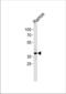 PHD Finger Protein 11 antibody, TA328158, Origene, Western Blot image 