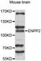 Ectonucleotide Pyrophosphatase/Phosphodiesterase 2 antibody, abx006722, Abbexa, Western Blot image 