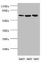 Catenin Beta Like 1 antibody, LS-C675605, Lifespan Biosciences, Western Blot image 