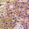 Death Domain Associated Protein antibody, GTX56298, GeneTex, Immunohistochemistry paraffin image 