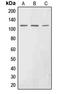 EPH Receptor A3 antibody, LS-C353723, Lifespan Biosciences, Western Blot image 