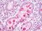 Trefoil Factor 1 antibody, orb96096, Biorbyt, Immunohistochemistry paraffin image 